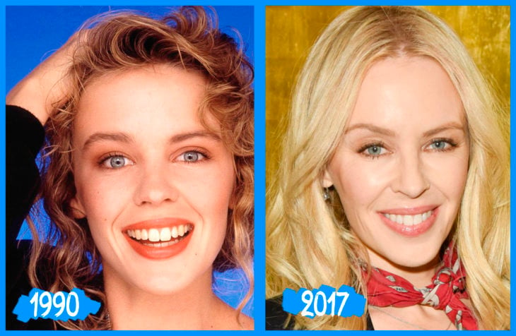 Kylie Minogue antes y después