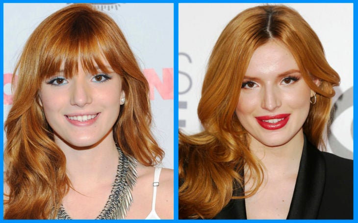 bella thorne antes y después de la cirugía