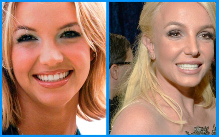 britney spears nariz antes y después de la cirugía