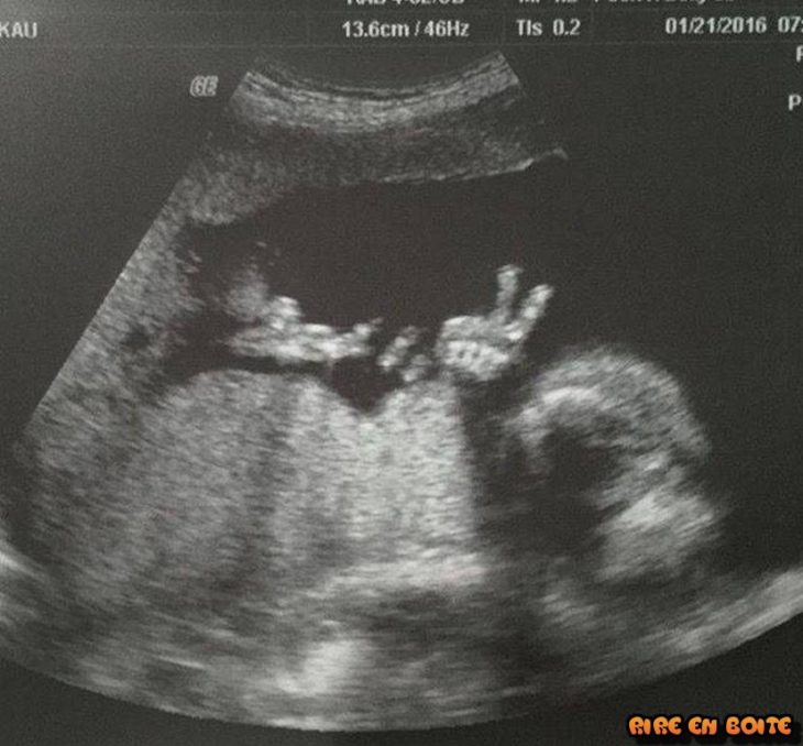 ultrasonido bebé saludando