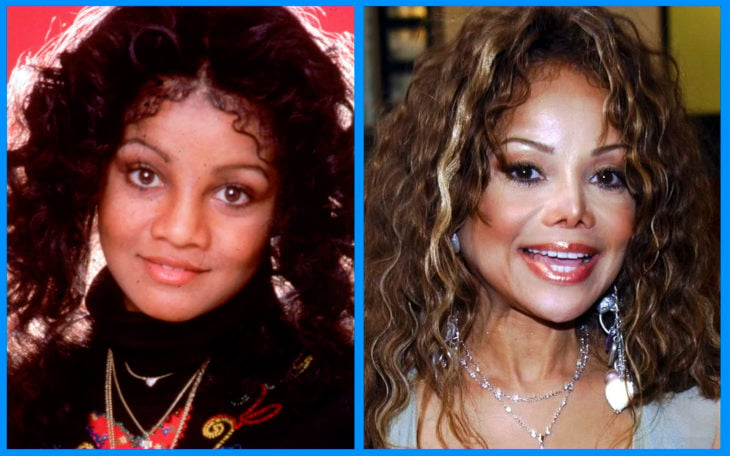 latoya jackson antes y después de la cirugía