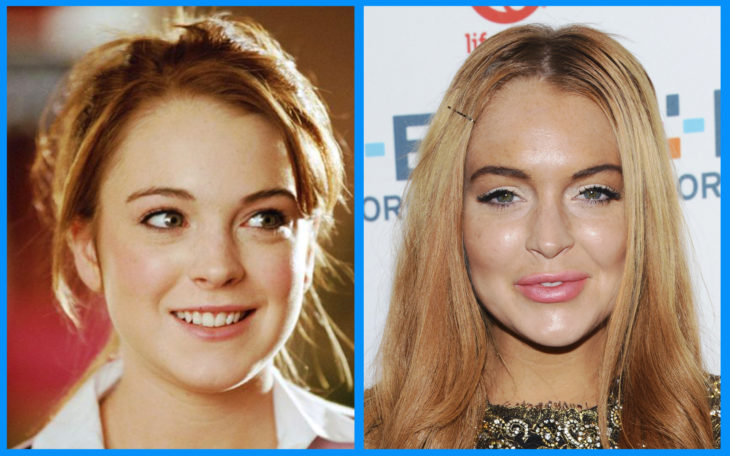 lindsay lohan antes y después de la cirugía