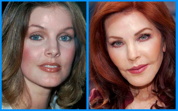 priscilla presley antes y después de la cirugía