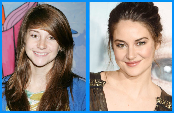 shailene antes y después