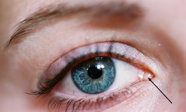 pliegue semilunar ojo lagrimal ojo 