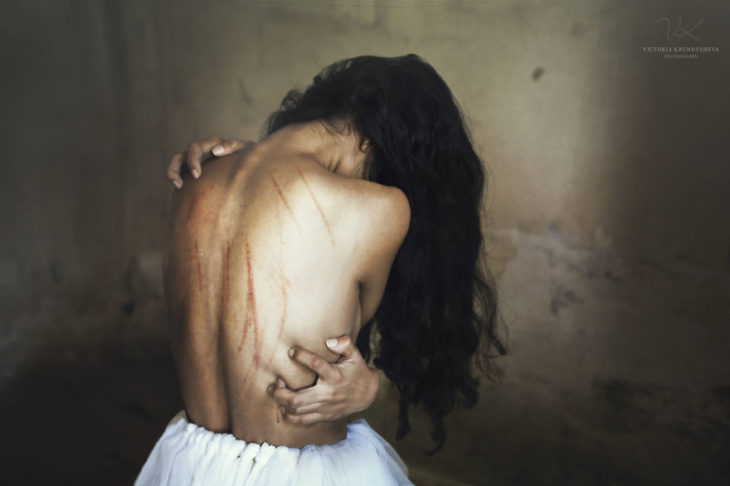 fotografía mujer con la espalda arañada 