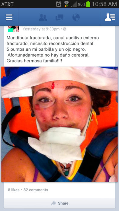 chica se toma selfie después de accidente 