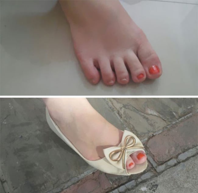 solo dos uñas del pie pintadas