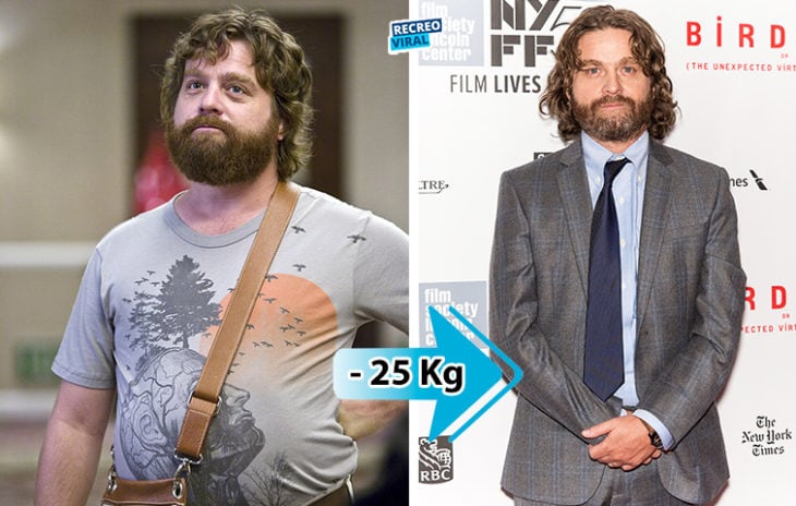 Zach Galifianakis