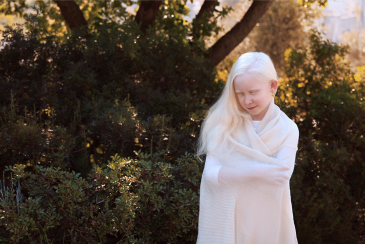 belleza albina niña portada