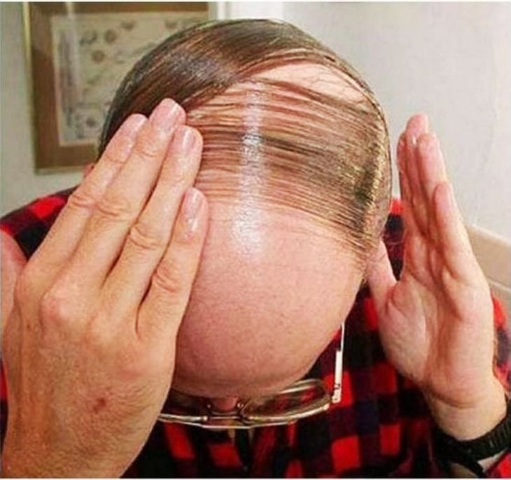 hombre peinandose pelos en la calvicie con gel