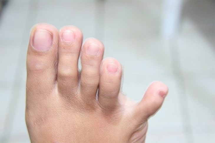 imagen de los dedos de los pies