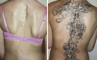 22 Cicatrices que se convirtieron en asombrosos tatuajes