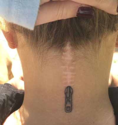 22 Cicatrices que se convirtieron en asombrosos tatuajes