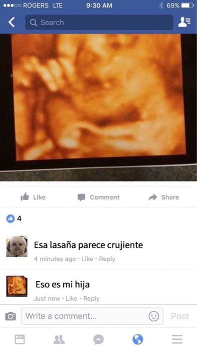 abuela confundé foto de un feto con lasaña 