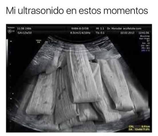 embarazo tamales