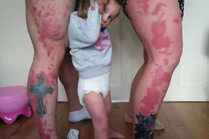 tatuaje de las manchas de nacimiento de su hija