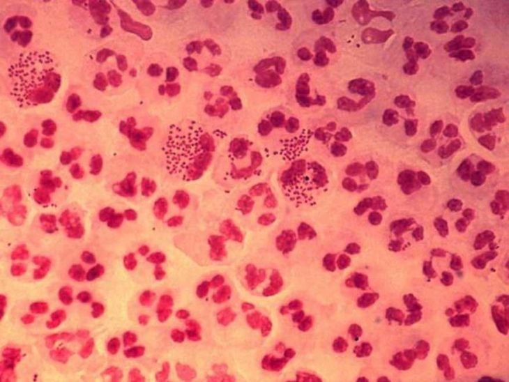 la bacteria de la gonorrea puede arrastras 100,000 veces su peso