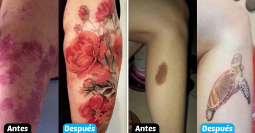 Cover Marcas de nacimiento que fueron transformados en geniales tatuajes