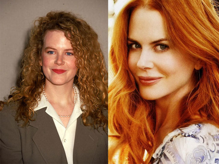 Nicole Kidman antes