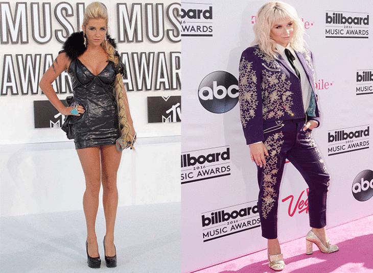 kesha antes y despues