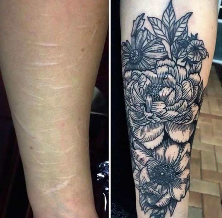 tatuaje cicatriz