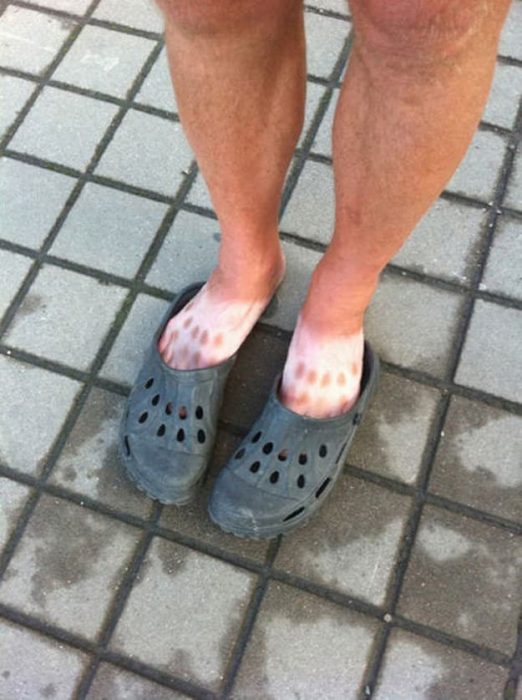 crocs