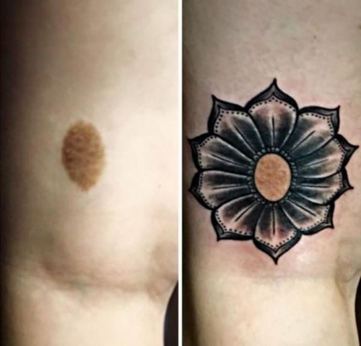 tatuajes sobre marcas nacimiento