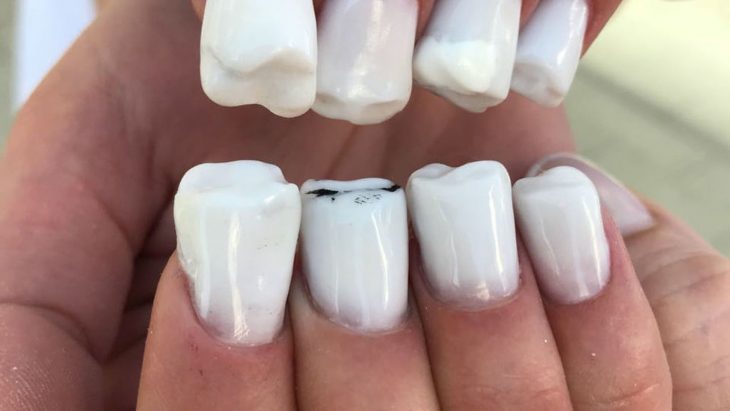 mano con uñas en forma de dientes 