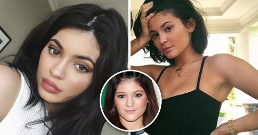 Cover Kylie Jenner se ha retirado los rellenos de labios